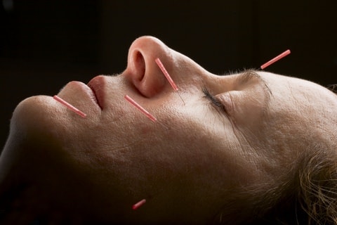 uso de acupuntura na geriatria e no paciente idoso