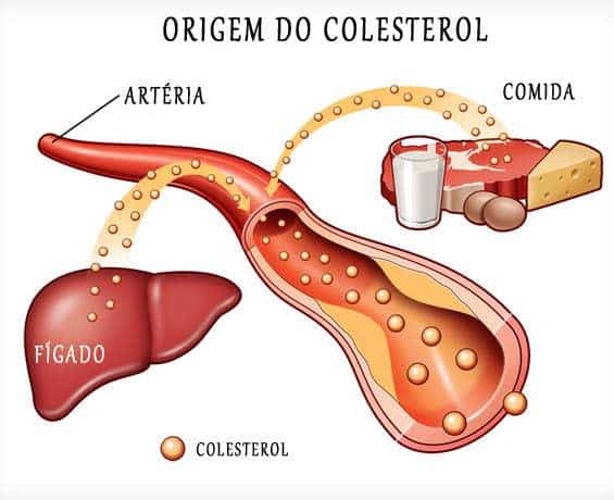 Corte seu colesterol - Clínica Dr. Hong Jin Pai - Acupuntura Médica