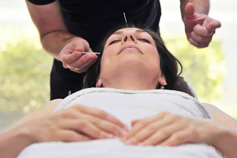 acupuntura medicina integrativa