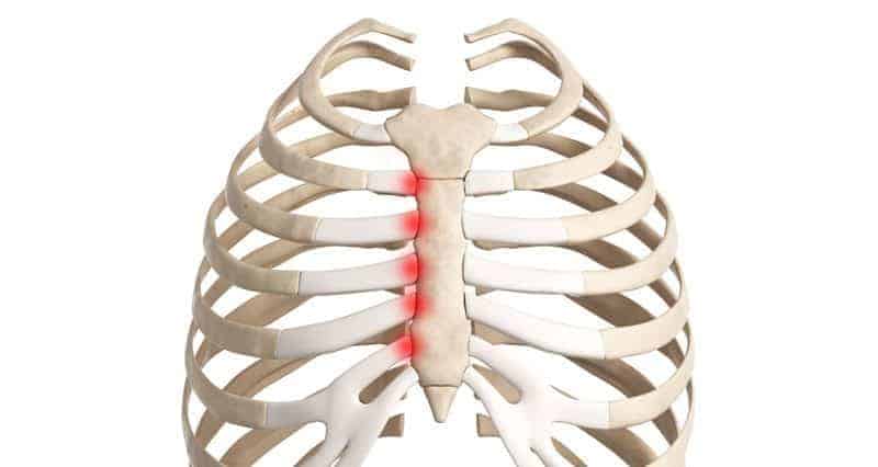 Costocondrite é uma inflamação na cartilagem que conecta uma costela ao esterno ou da própria costela. Esta condição leva a dores no peito