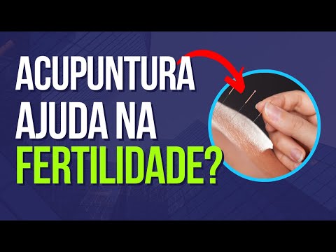 Tudo Sobre Acupuntura e Fertilidade: Uma Explicação Prática