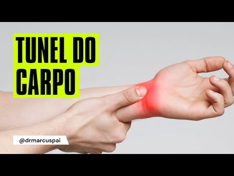 DOR NAS MÃOS: Síndrome do Túnel do Carpo - Causas, Sintomas, Diagnóstico e Tratamento