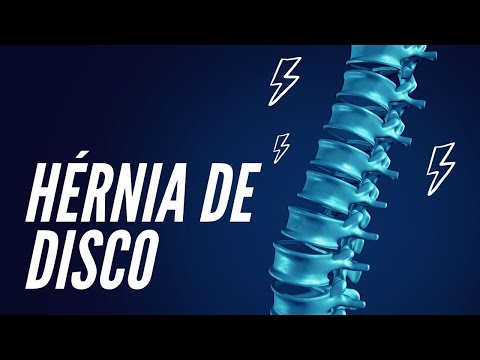 Hérnia de Disco: O que é, sintomas e causas