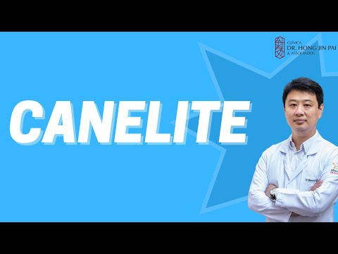 CANELITE - Síndrome do Estresse Tibial Medial - Causa comum de dor nas pernas em corredores.