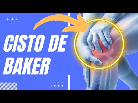 Cisto de Baker - Dor atrás do joelho - Causas e tratamentos