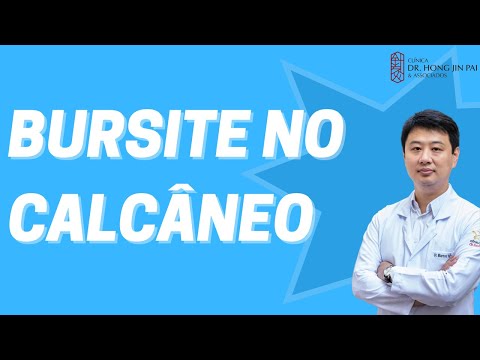 Bursite no Calcâneo - Dor no Tornozelo e Calcanhar