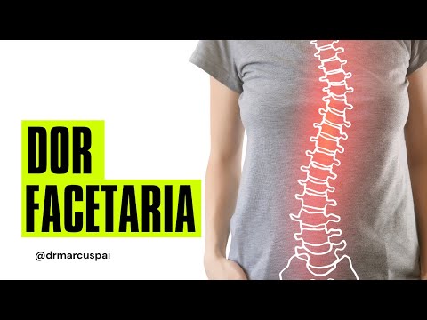 Dor Facetária - Artrose da Articulação das Facetas - Dor na Coluna - Aprenda Mais