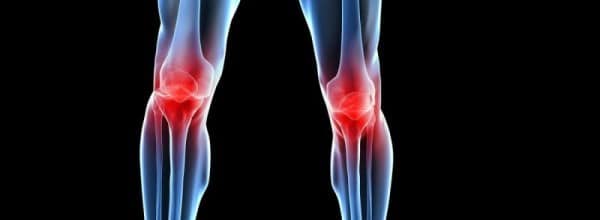 osteoartrose de joelhos dor regional