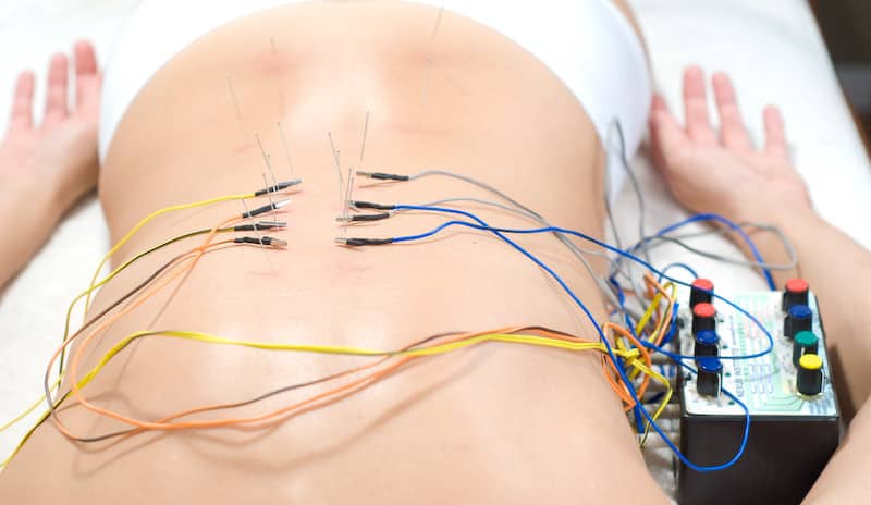 dr marcus yu bin pai, acupuntura e fisiatria