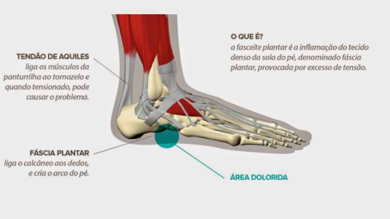 Do osso tornozelo no formigamento