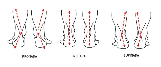 Diagrama de três pares de tornozelos vistos por trás mostrando os padrões de apoio pronado, neutro e supinado, com setas vermelhas indicando o eixo de carga.