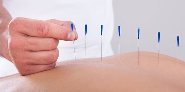 acupuntura tratamento de pele dermatologia