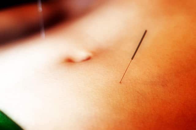 acupuntura e obesidade
