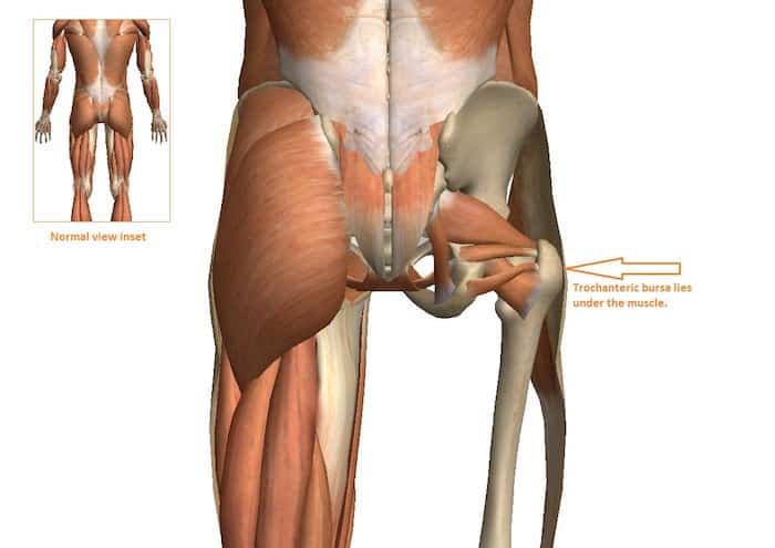 anatomica da bursite trocanterica