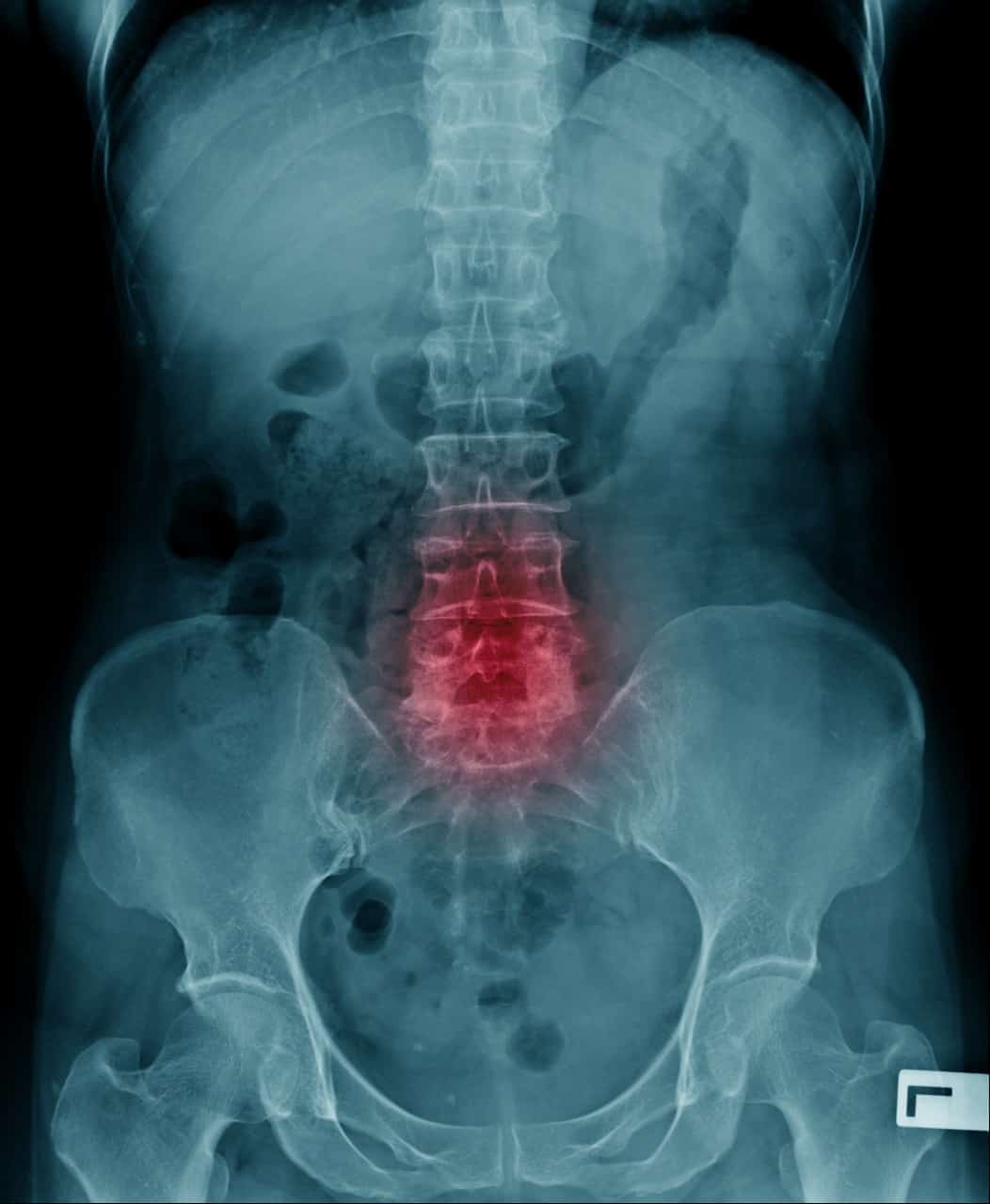 coluna vertebral