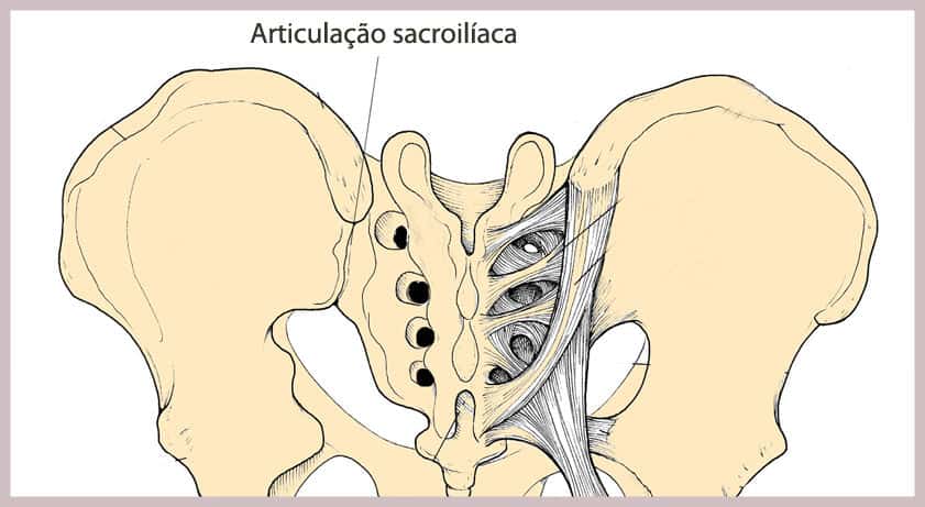 dor na articulacao sacroiliaca