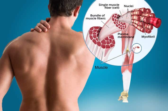 Inteiro espasmos de o musculares pode corpo causar que