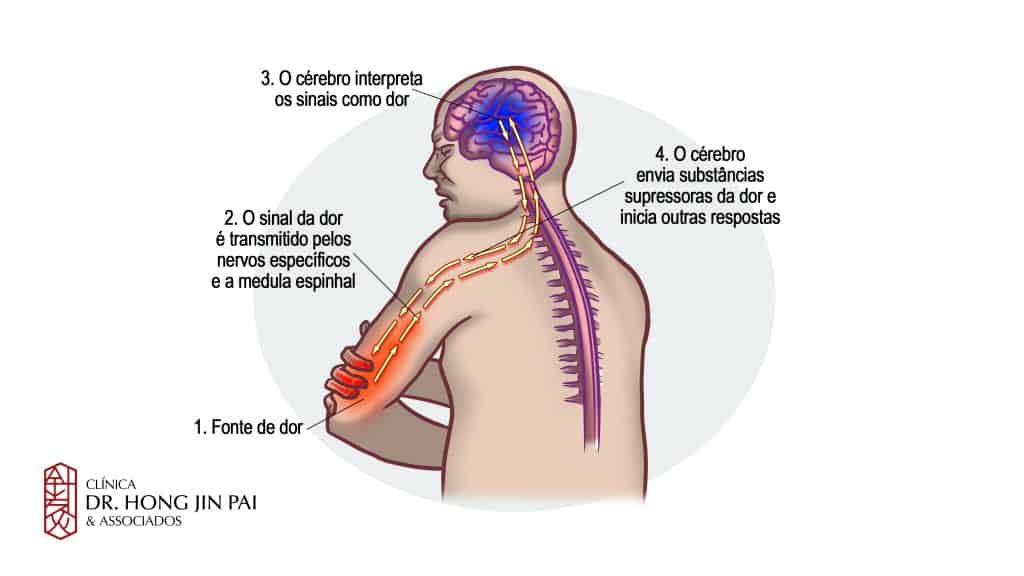 Evolução da Dor e Processamento Sistema Nervoso Central