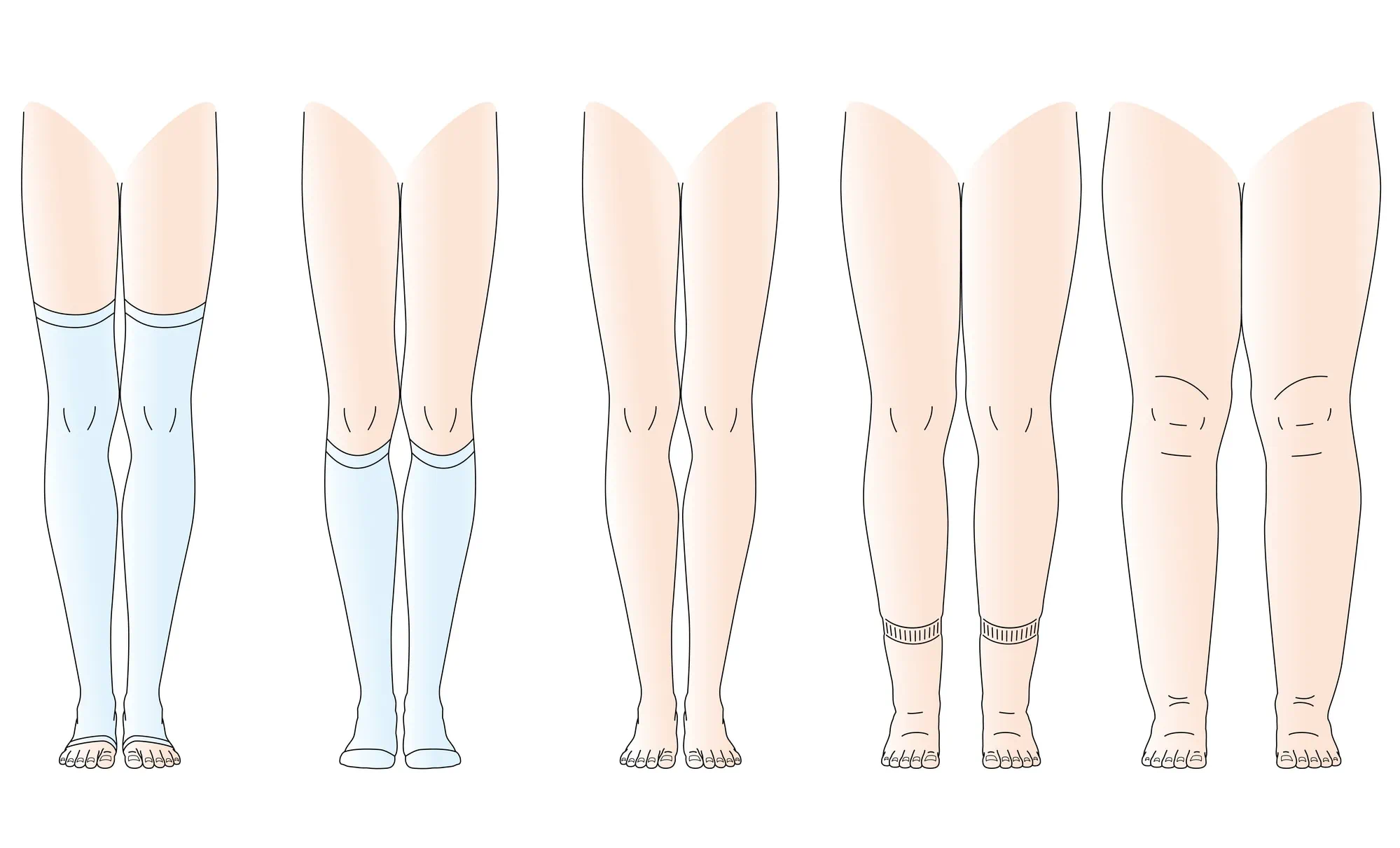Meias de compressão – as meias ajudam a diminuir a pressão da gravidade