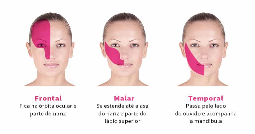 Da cirurgia no mandíbula da dor nervo