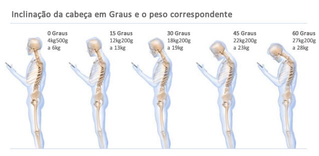 E cima baixo perna na para esquerda dor para movendo se