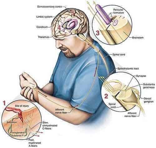 sindrome complexa de dor regional diagnostico
