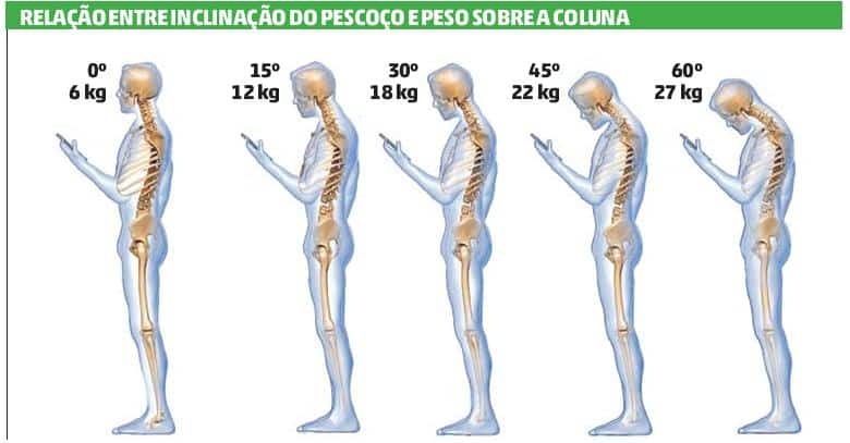 Sequência de cinco silhuetas de perfil com o esqueleto visível, inclinando a cabeça de 0 a 60 graus para olhar o celular, com o peso sobre a cervical subindo de 6 a 27 kg.
