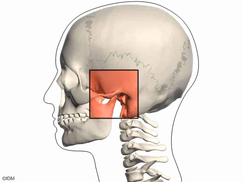 articulacao temporo mandibular dtm