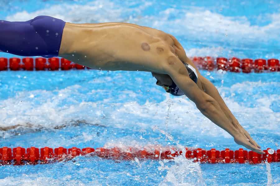 Costas de nadador olímpico em piscina de competição com marcas circulares arroxeadas deixadas pela ventosaterapia