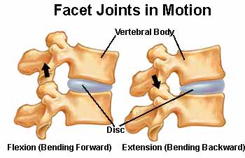 Diagrama de duas vértebras com disco mostrando as facetas em flexão (inclinar para frente) e em extensão (inclinar para trás), com setas indicando o movimento.