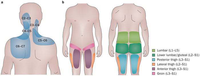 padrao de dor facetaria cervical lombar