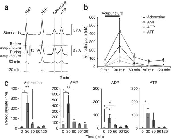 adenosina-acupuntura