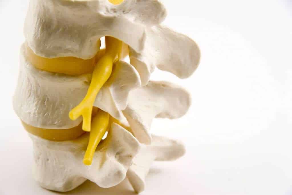 Modelo anatômico tridimensional de três vértebras lombares empilhadas com discos intervertebrais e raízes nervosas em amarelo saindo entre os corpos vertebrais