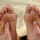 Dor crônica: O que é Neuropatia Diabética?