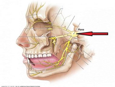 neuralgia-do-trigemeo