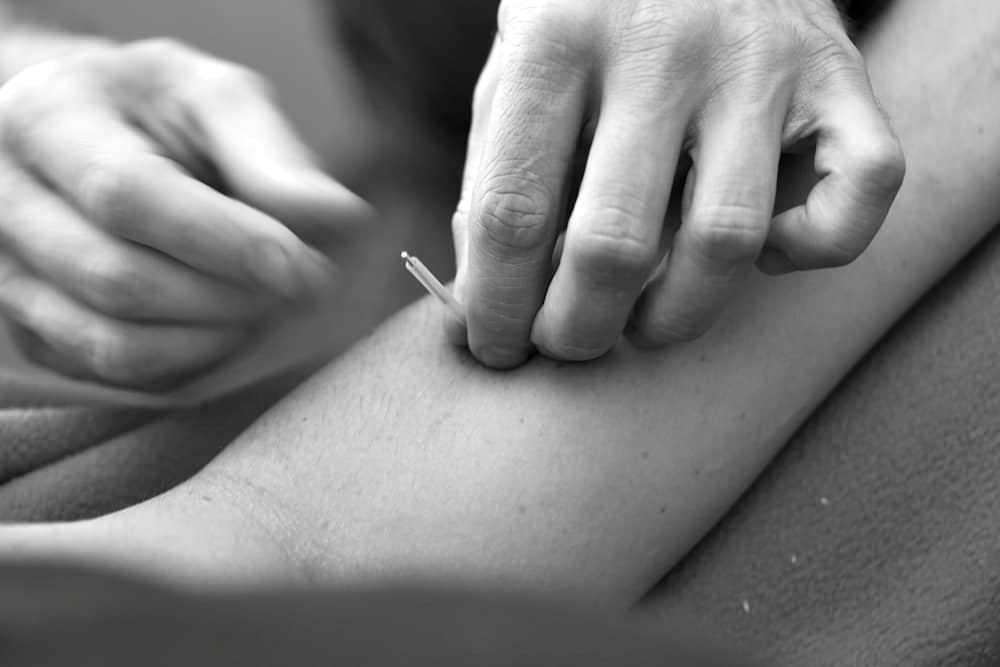 acupuntura braco marcus yu bin pai