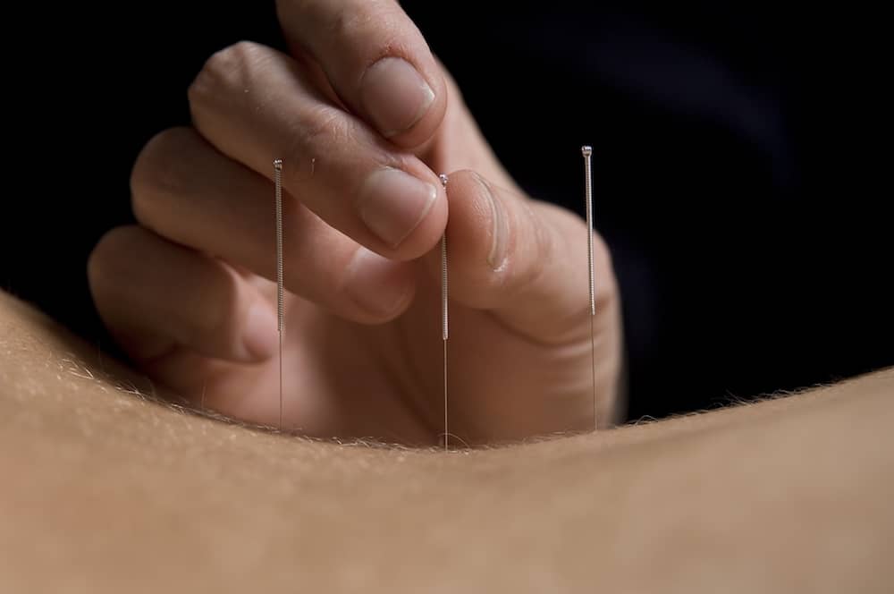 acupuntura ceimec marcus yu bin pai