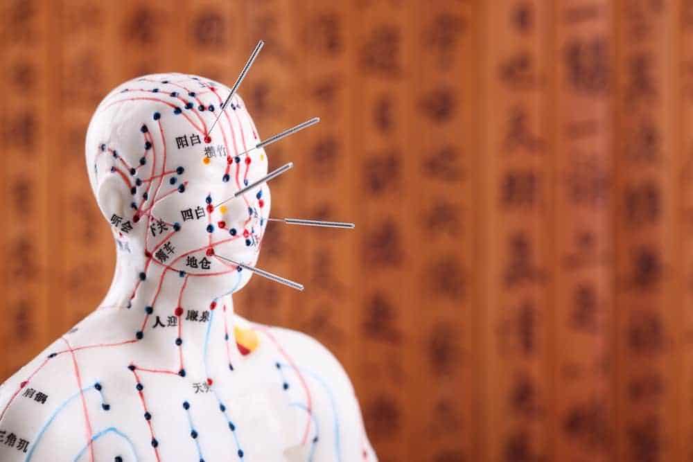 modelo de acupuntura sao paulo