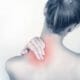 10 Dicas para Prevenir Dores no Pescoço (Torcicolo)