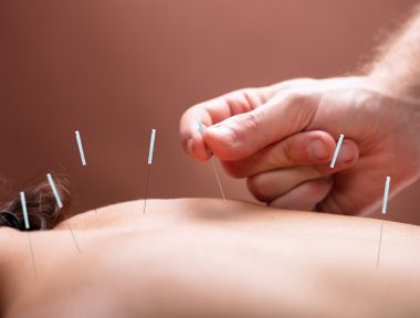 A Acupuntura é uma modalidade terapêutica desenvolvida na China há mais de 5.000 anos