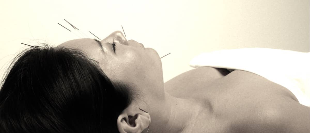 acupuntura relaxamento sao paulo