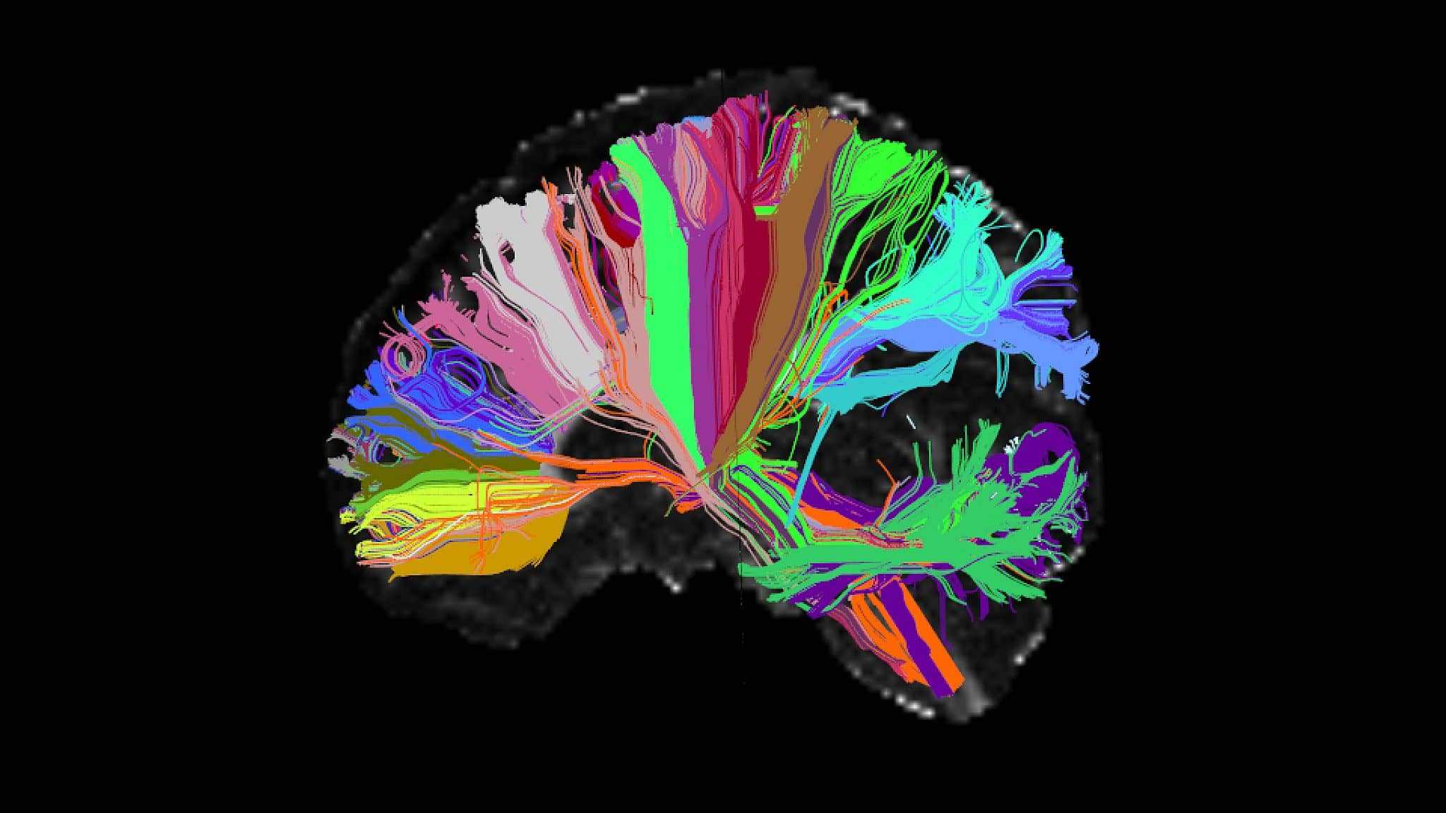 mapa cerebro dor