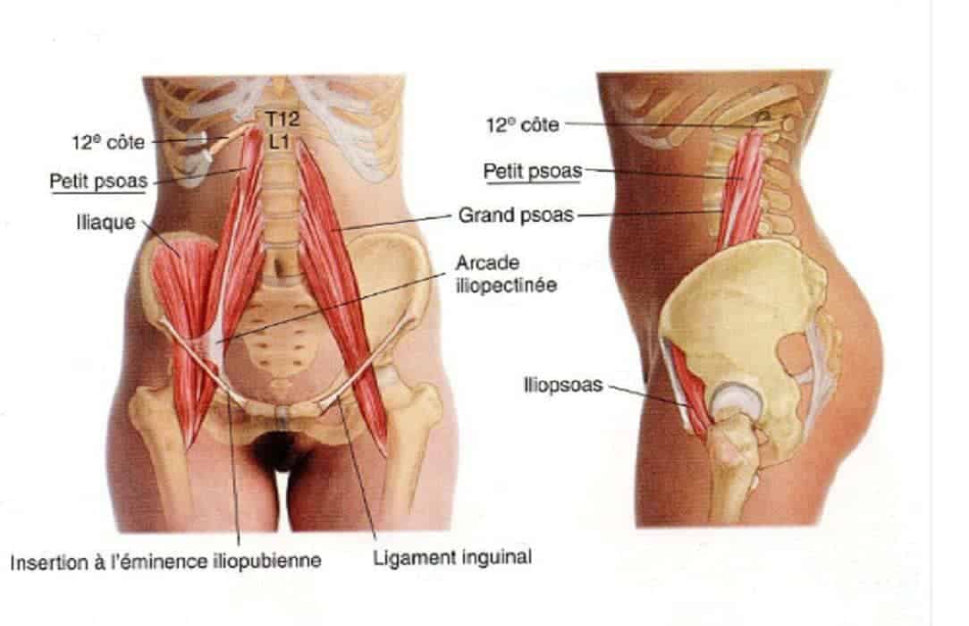 sindrome iliopsoas