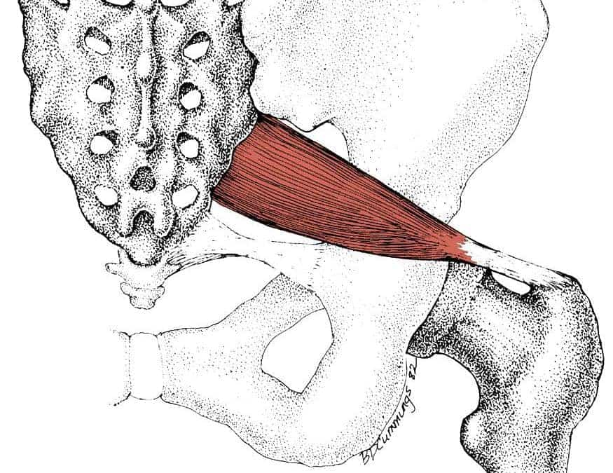 sindrome piriforme