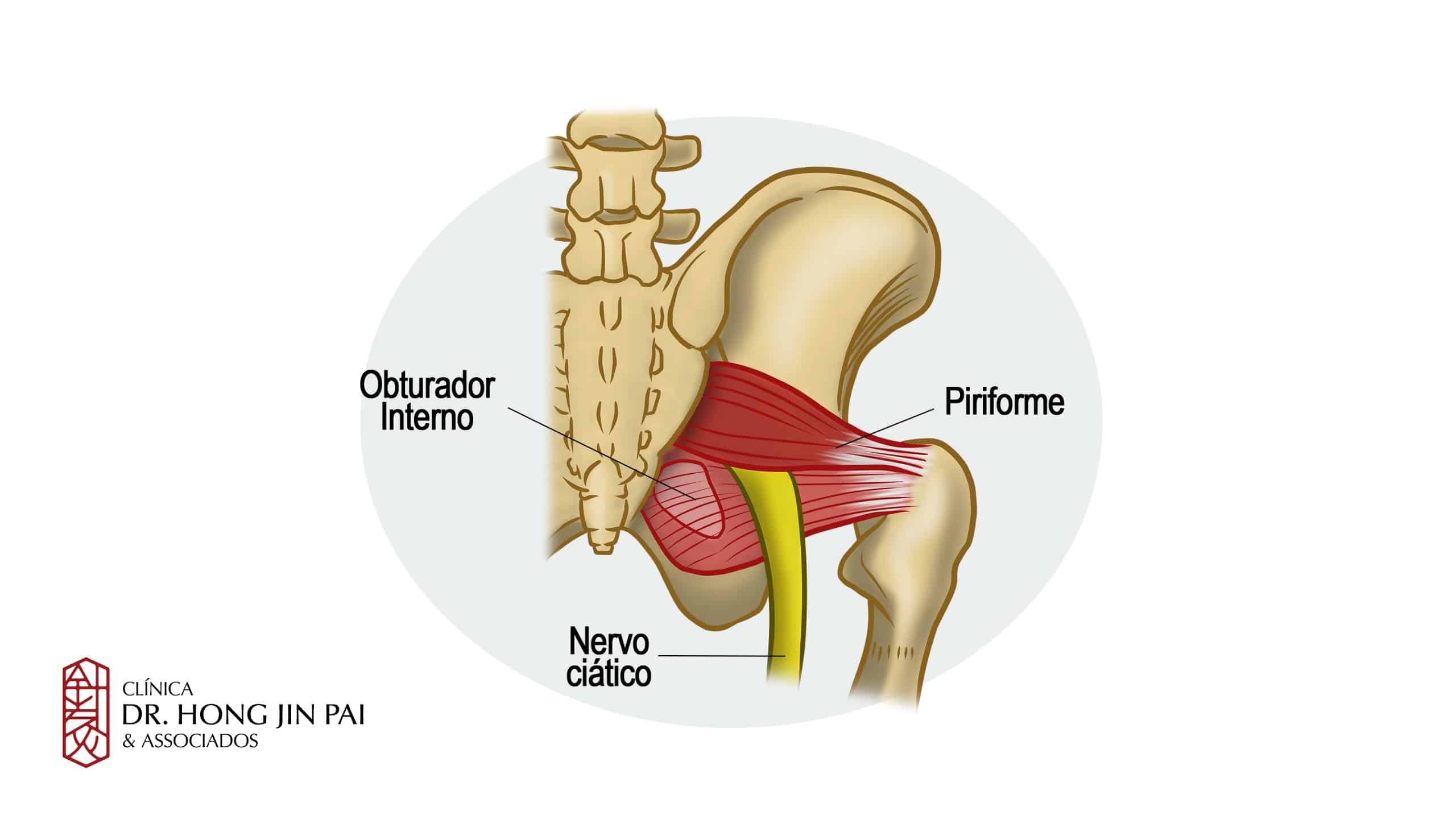 MUSCULO PIRIFORME scaled