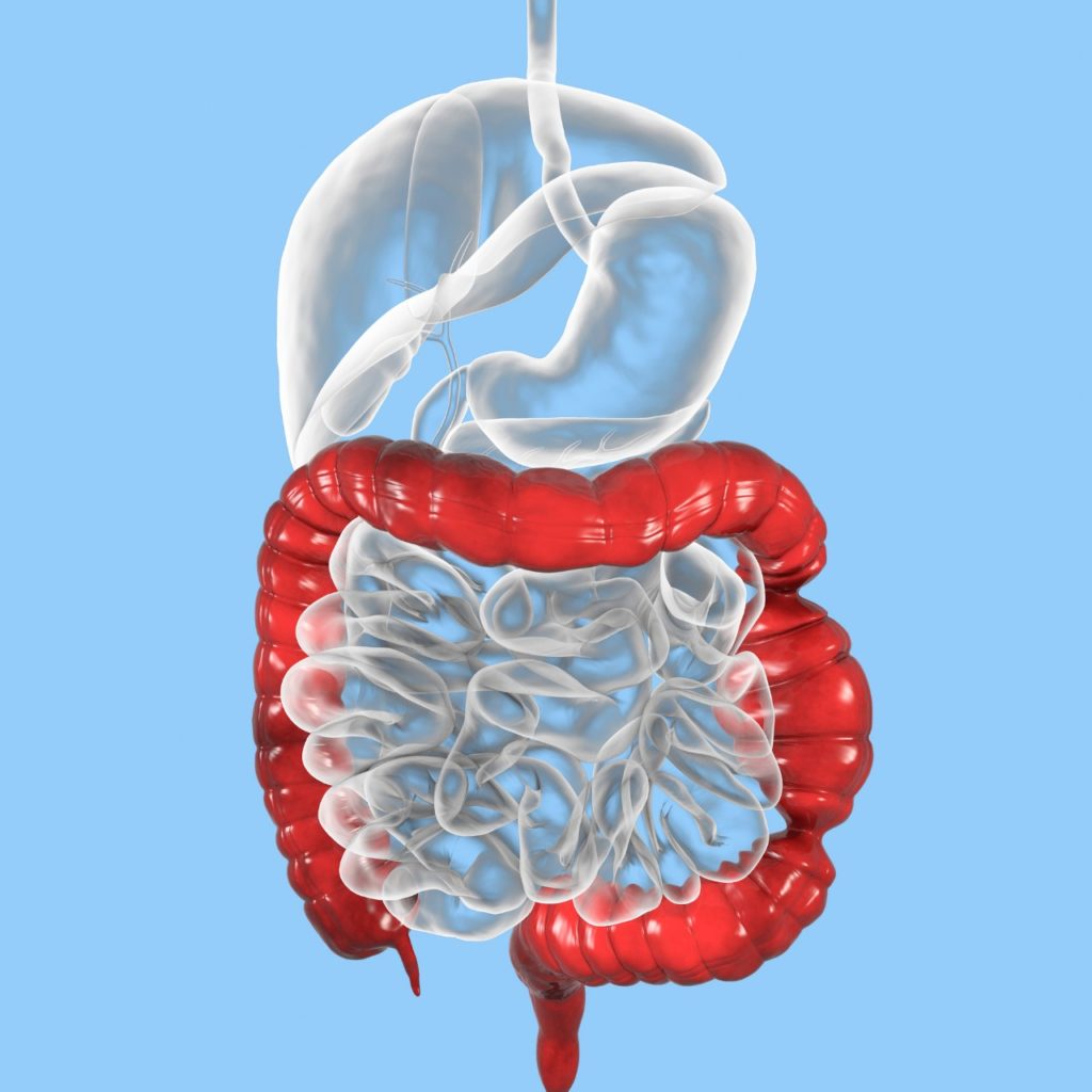 Render 3D do trato digestivo com o intestino grosso (cólon) destacado em vermelho ao redor das alças do intestino delgado.