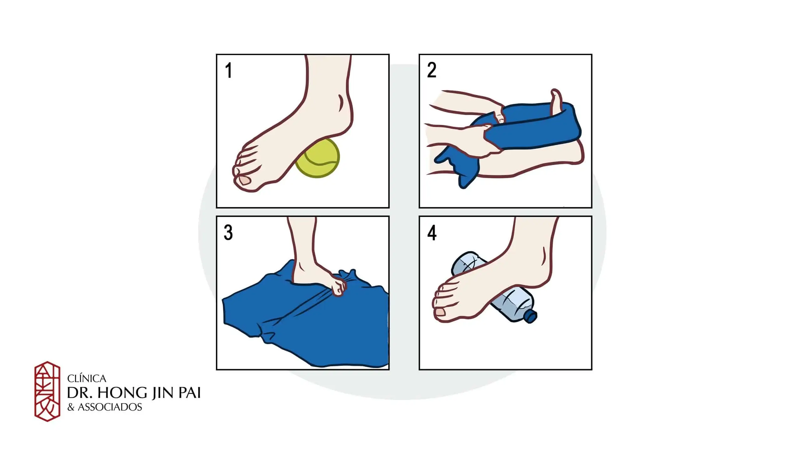 Exercicios Fascite Plantar e Esporao do Calcaneo