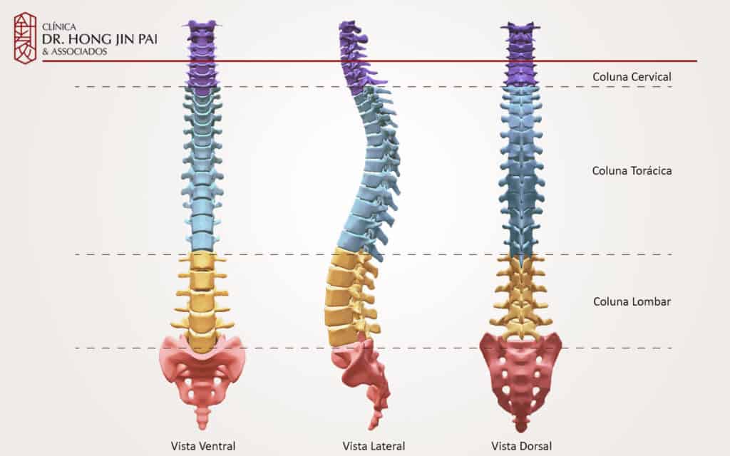 Diagrama da coluna vertebral em três vistas (ventral, lateral e dorsal) com os segmentos cervical em roxo, torácico em azul e lombar em amarelo, além do sacro em vermelho.