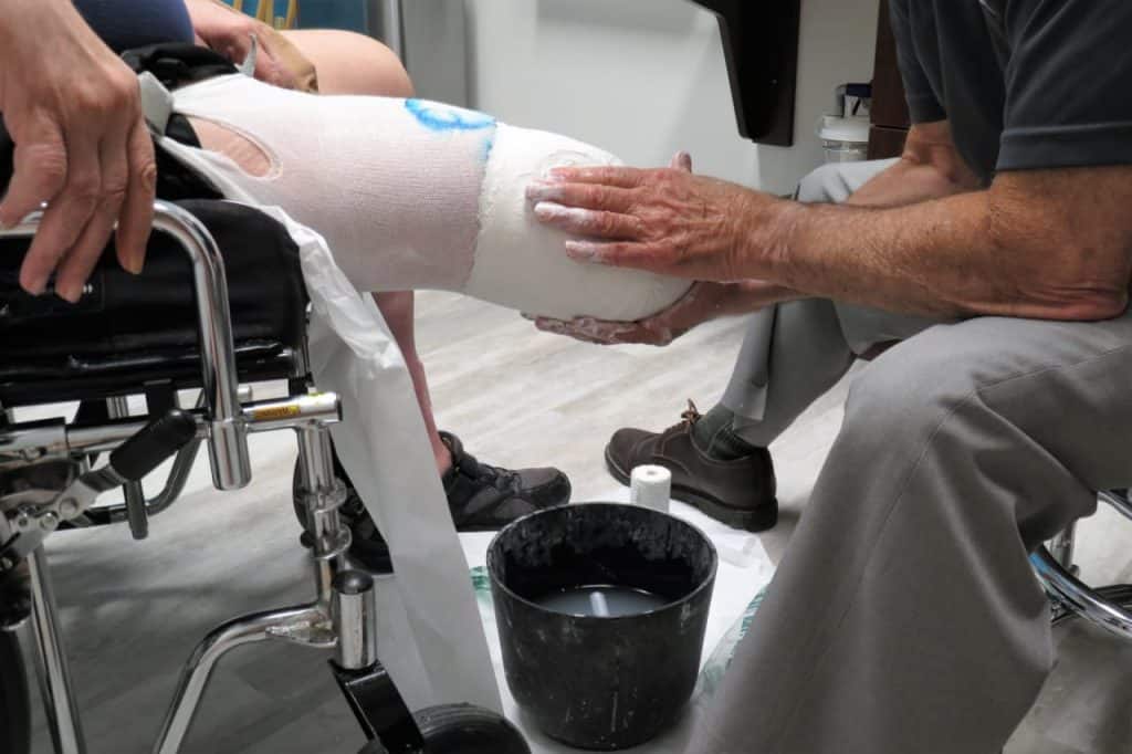 Profissional moldando um molde de gesso sobre o coto de um paciente idoso em cadeira de rodas no consultório