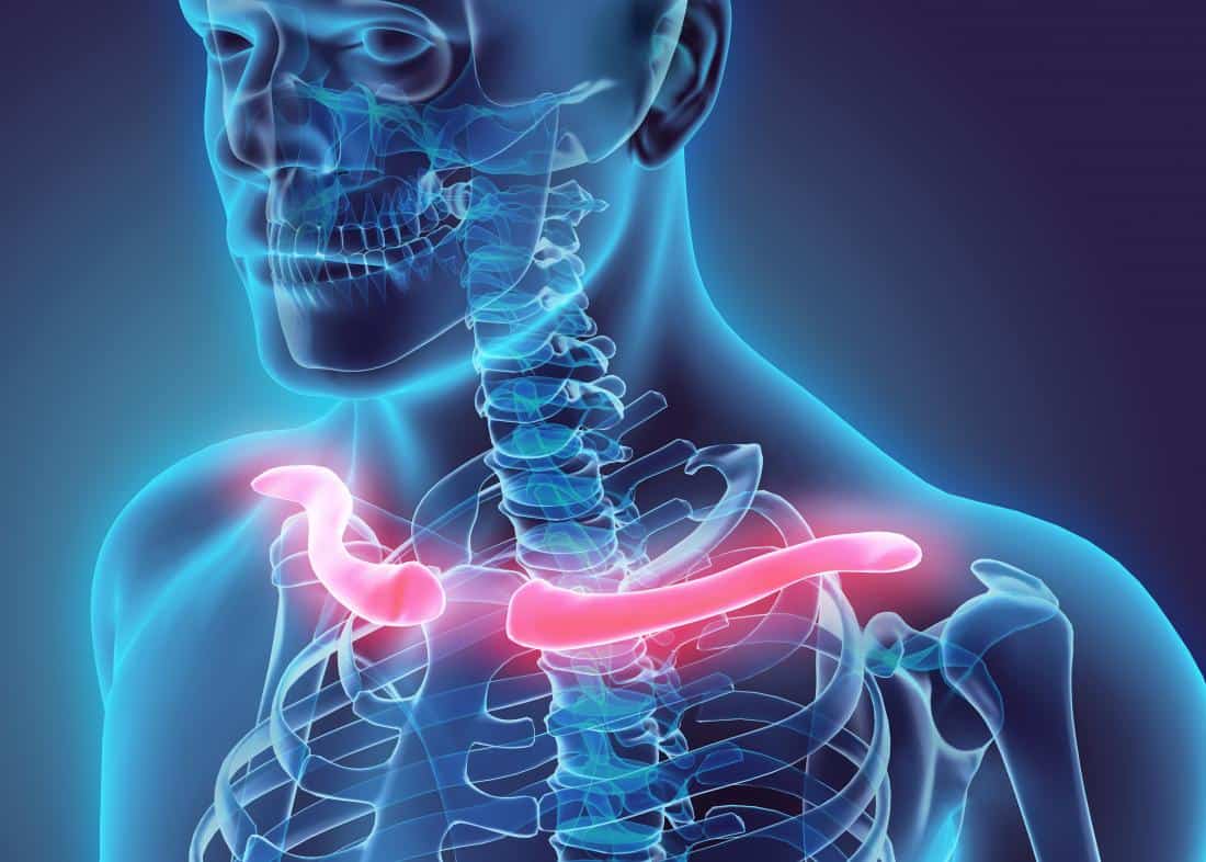 O ombro é a articulação mais móvel do corpo humano, no entanto sua grande amplitude de movimentos a torna suscetível a lesões. Um dos ossos que se encontram nessa estrutura é a clavícula, conhecida popularmente como “saboneteira”. Devido à localização, não é incomum que lesões nos membros superiores causem dor na clavícula.